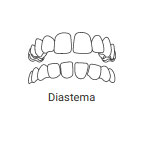 Dentista Invisalign em Campinas