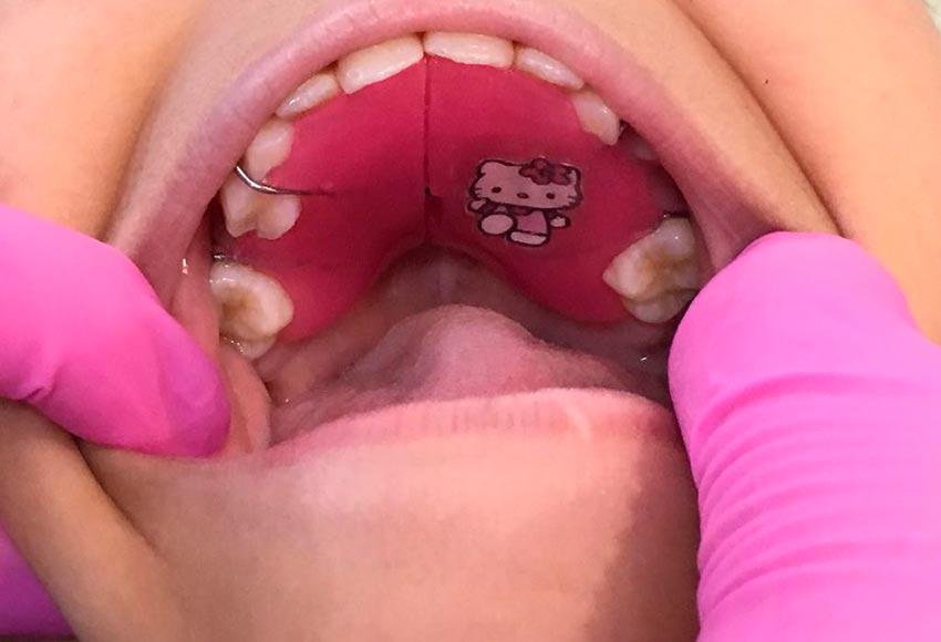 Ortodontista Infantil Campinas